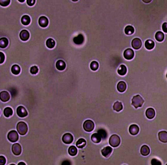 Zorb Blood Cells