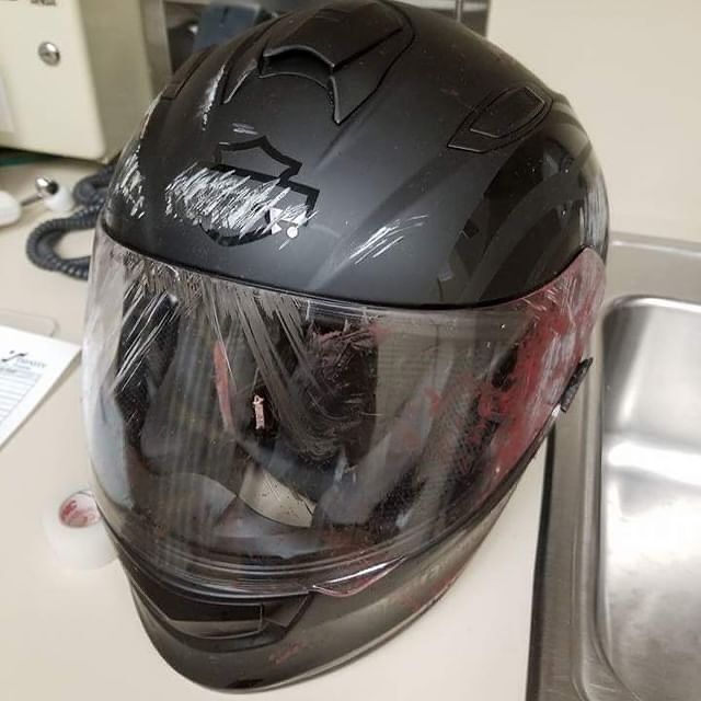 Why you should wear your helmet (7)