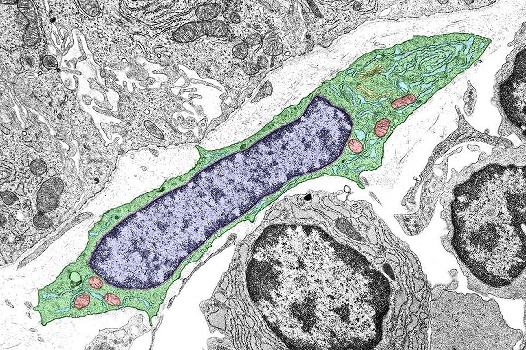 fibroblast (connective tissue) - 線維芽細胞 (結合組織) -