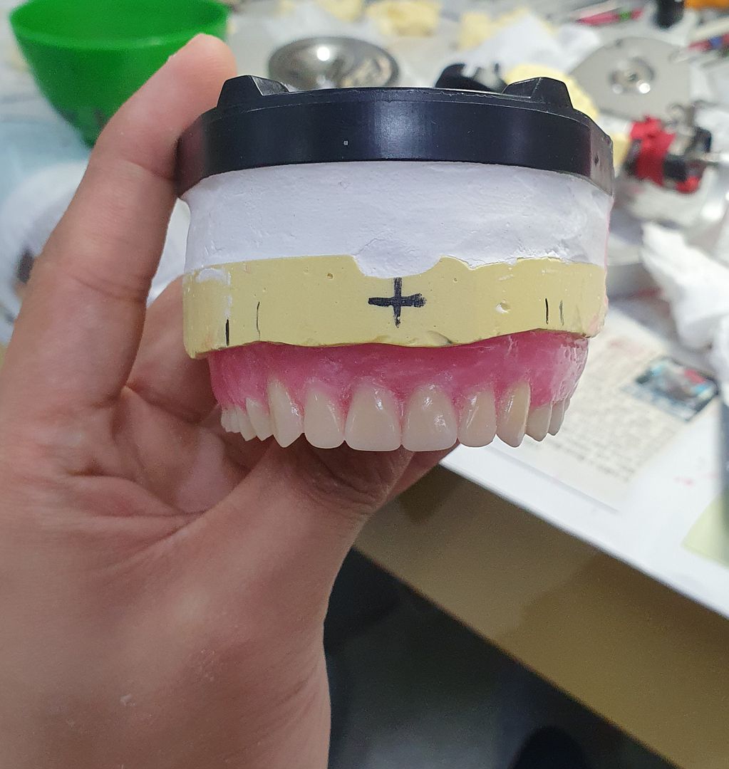 First denture